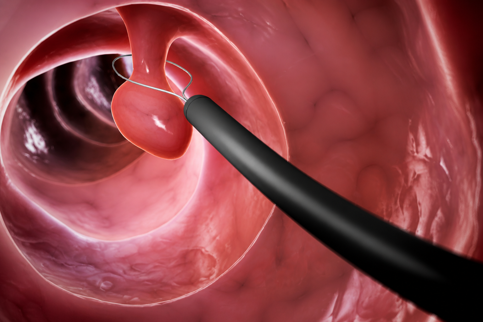 category featured image